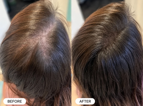 Aviron® Thinning Hair Repair Spray